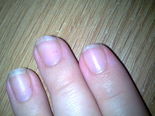 This is what my nails look like before I treat them.