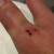 The top of the thumb hit the overhanging cupboard. The top of the thumb hit the overhanging cupboard.
