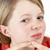 10acne profile image