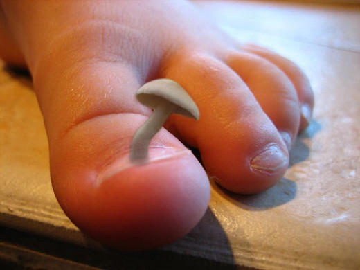 Acrylic Nail Fungus Nail Fungus Pictures On Under Acrylic
