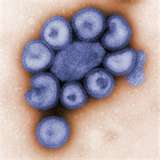 Swine flu virus.          Credit: flupulsetoday.co.uk