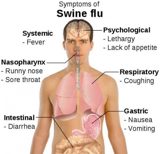 Swine flu symptoms in humans