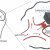 Ischaemic stroke
www.strokerehabitunit.ie Ischaemic strokewww.strokerehabitunit.ie