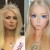 Photo of Valeria Lukyanova's  before and after Plastic Surgery