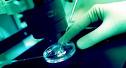 therapeutic cloning