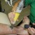 Professional black and teal tattoo during the first treatment. The white coloring is called laser snow. It is steam from the skin that rises to the surface. The steam dissipates in as little as a few minutes to as many as 20 or 30. Professional black and teal tattoo during the first treatment. The white coloring is called laser snow. It is steam from the skin that rises to the surface. The steam dissipates in as little as a few minutes to as many as 20 or 30.