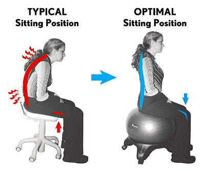 Good posture helps stroke patients in achieving good quality of life.
