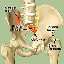 SI joint & Voltaren Gel | HubPages