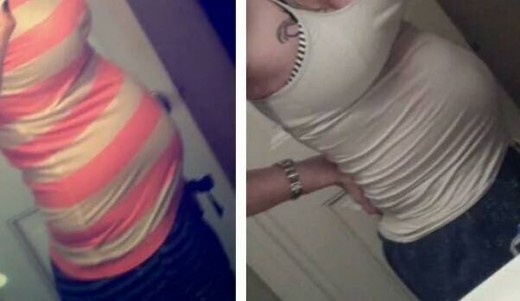 Regular belly verses Braxton Hicks belly. It will tighten up tremendously and shouldn't hurt. Just uncomfortable. (this is a personal picture taken at 28 weeks and on the same day)