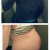 You can clearly tell the baby has dropped out of the ribs and is entering the pelvis!