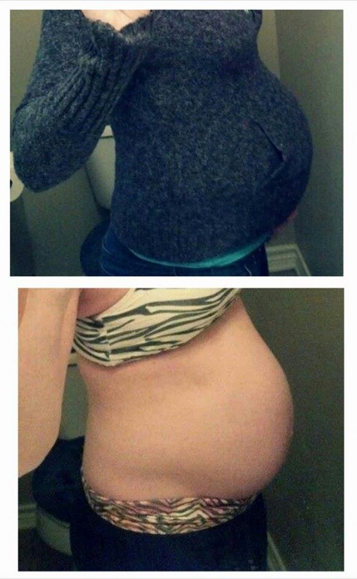You can clearly tell the baby has dropped out of the ribs and is entering the pelvis!
