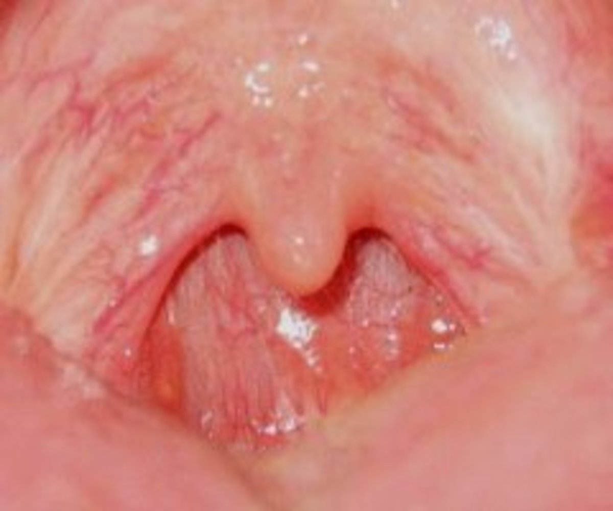 Healthy Throat Picture 20