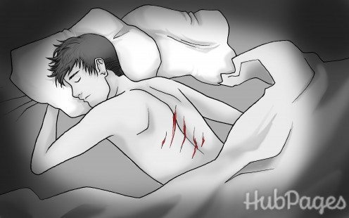 Waking Up with Three Unexplained Scratches on My Body Waking Up with Three Unexplained Scratches on My Body