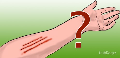 What Are These 3 Strange Scratches on my Body? (With Photos) What Are These 3 Strange Scratches on my Body? (With Photos)