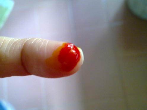 My bloody finger