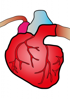 High LDL Cholesterol Causes Heart Diseases
