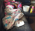 Best Ways to Treat Flu Patients at Home