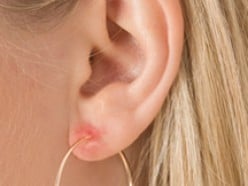 Women with Metal Allergie on ear
