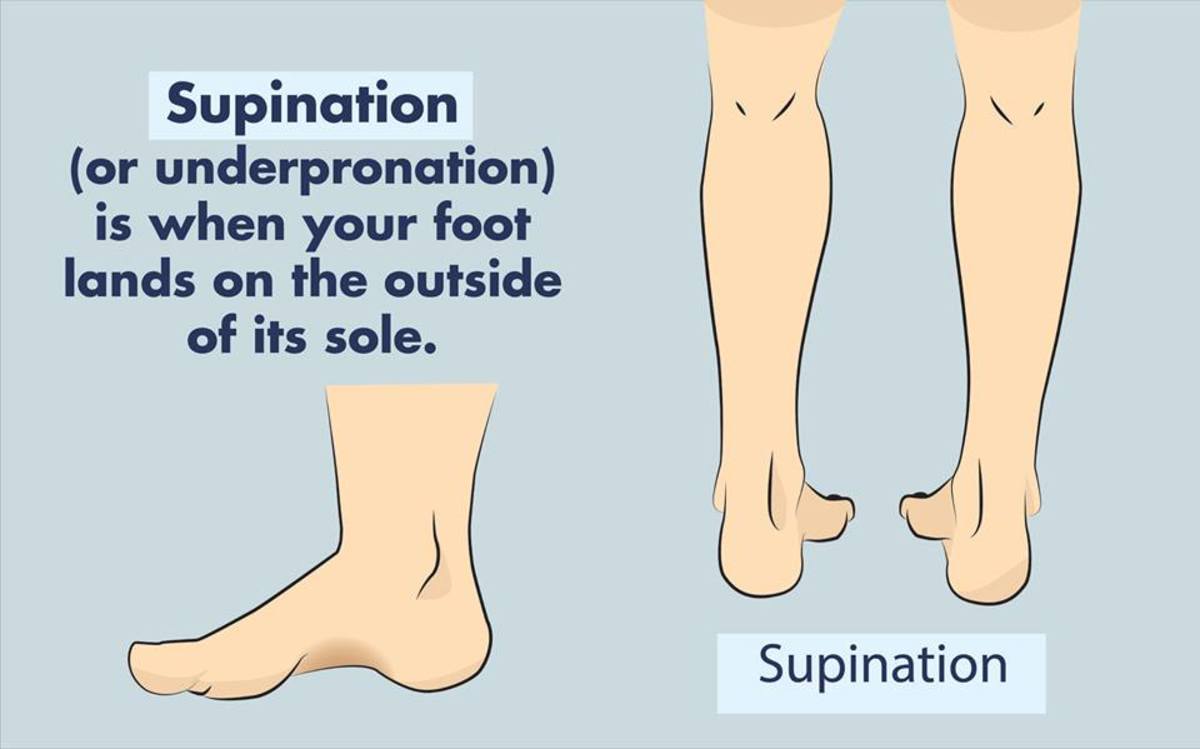 Best Running Shoes for Supination:  Top Athletic Shoe Models for Underpronation