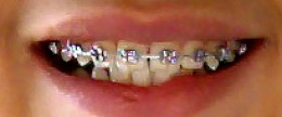https://usercontent1.hubstatic.com/12089558_f260.jpg