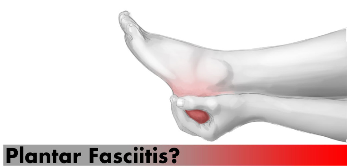 Shoes We Use for Plantar Fasciitis: What Works, What Hurts