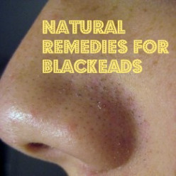 Natural Remedies for Blackheads