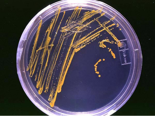 Colony of bacteria growing in a petri dish