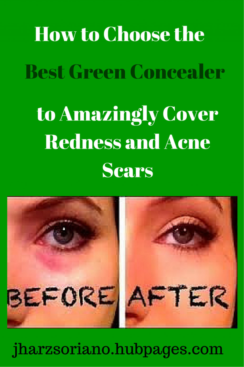 How to Choose the Best Green Concealer to Amazingly Cover Redness and