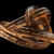This is a knot in a human blonde hair, magnified at 50x. This is a knot in a human blonde hair, magnified at 50x.