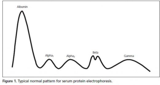 Fig. C: Typical normal pattern for serum protein electrophoresis