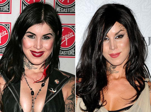 Kat Von D Plastic Surgery Before & After Look