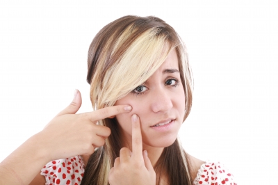 Girl with Acne