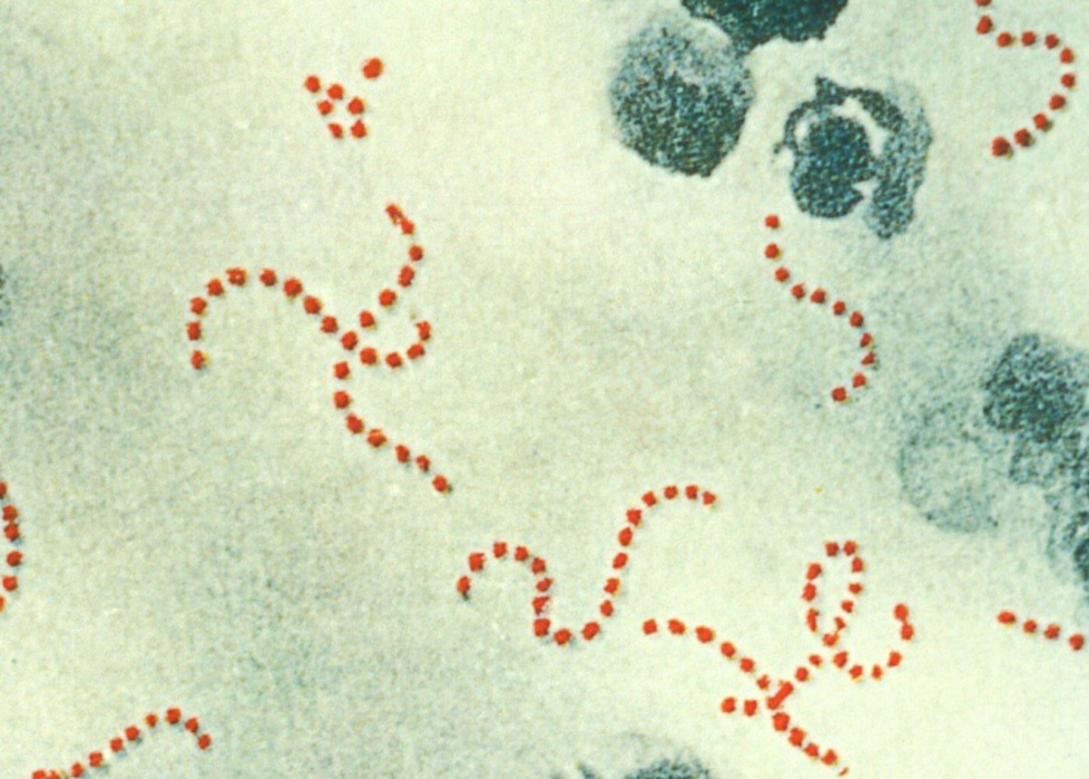Groups A and B Streptococcus Bacteria: Facts and Effects | HubPages