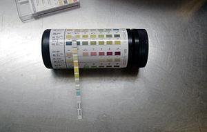 A doctor uses a dipstick kit like this to test for a urinary tract infection