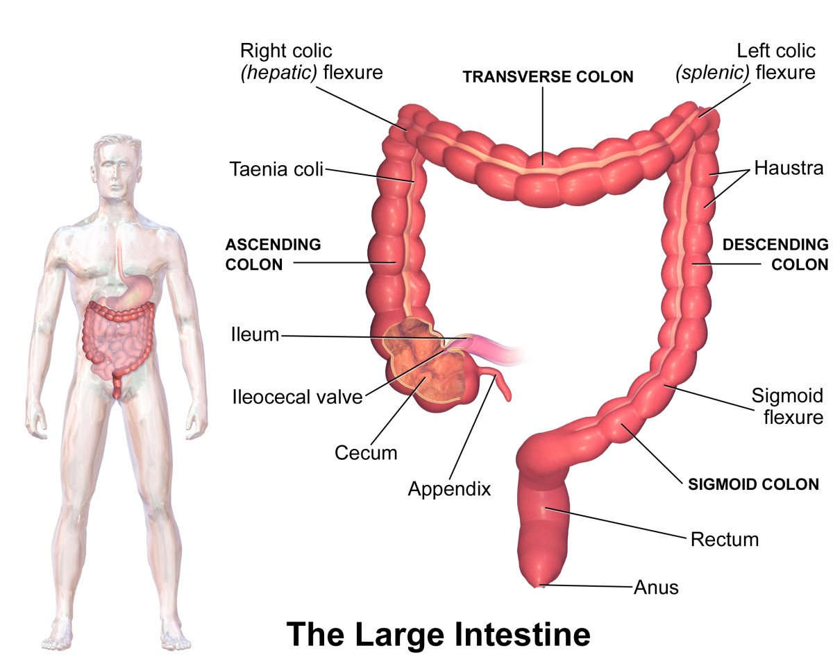 Crohn's disease most often develops in the ileum at the end of the small intestine and in the part of the colon nearest to the ileum.