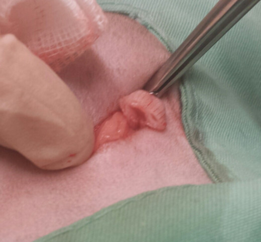 The cut surface of the cervix is inspected to ensure it is not bleeding before being released.
