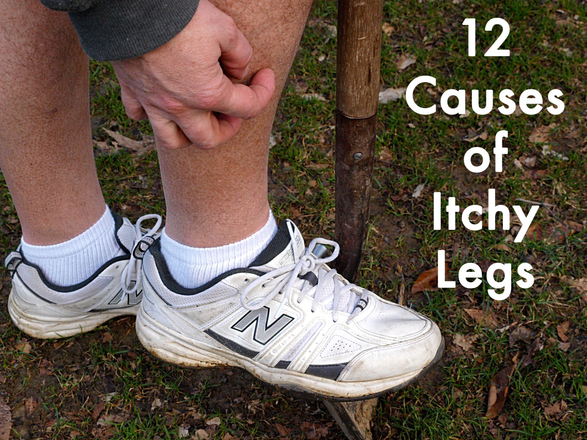 12 Causes of Itchy Legs | HubPages