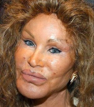 Plastic Surgery gone wrong