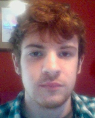 Within the second week, the swelling went down a good number.