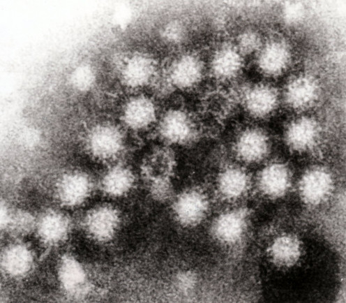 Norovirus under microscope
