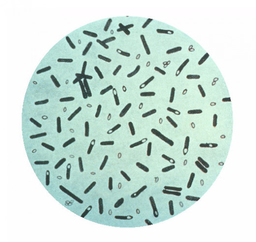 "Clostridium botulinum" by Content Providers: CDC - This media comes from the Centers for Disease Control and Prevention's Public Health Image Library (PHIL), with identification number #2107.