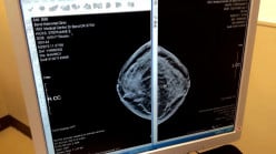 Detecting Breast Cancer With a Self-Exam Check
