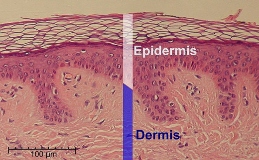 Epidermis and Dermis