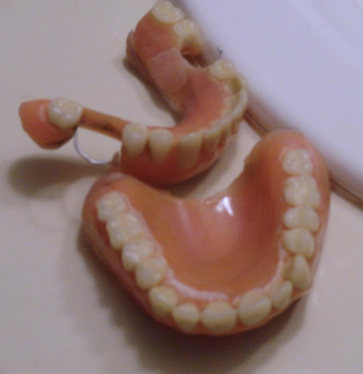 My husband's dentures