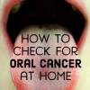 How To Self Check For Oral Cancer