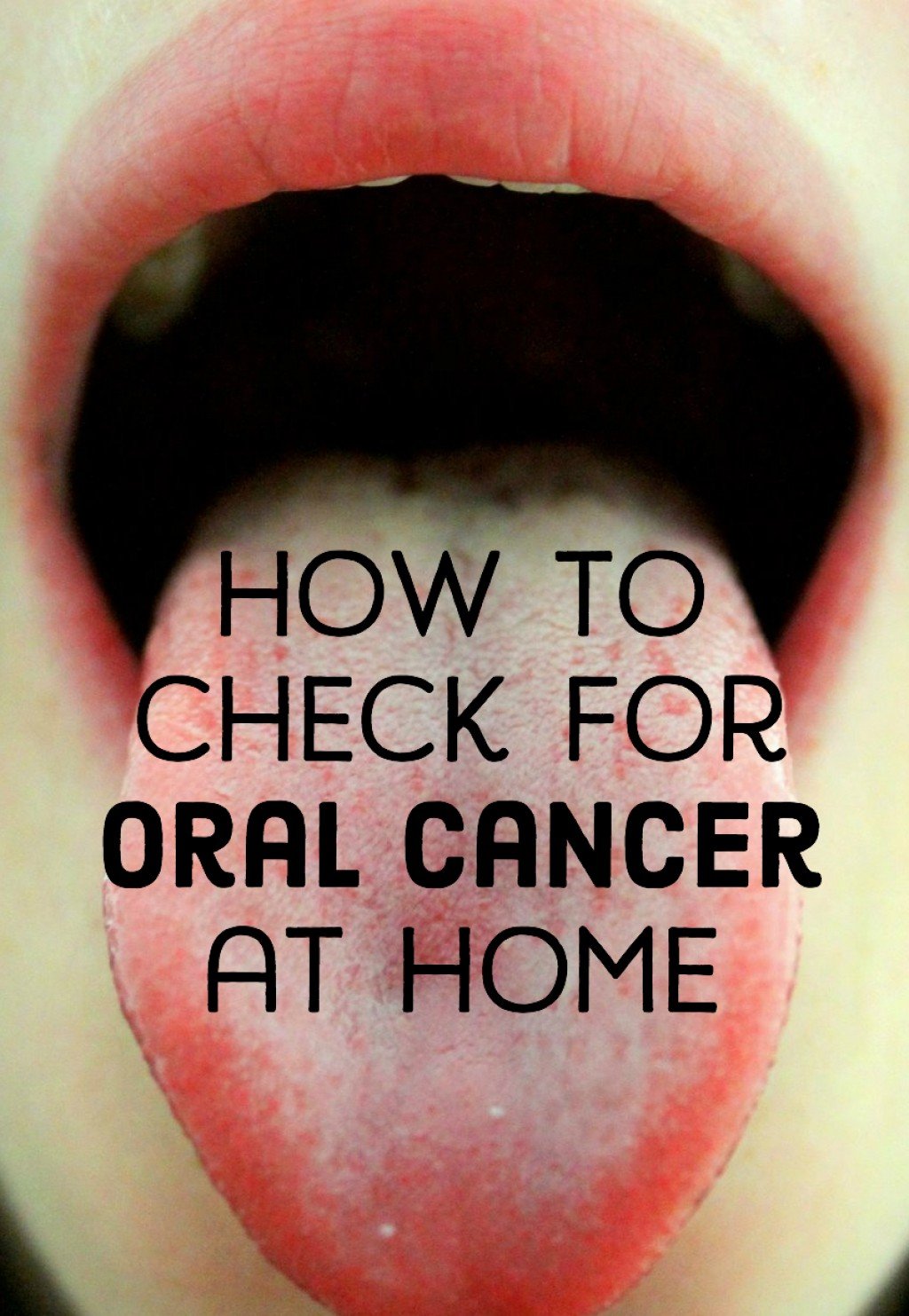 How To Self Check For Oral Cancer Healdove