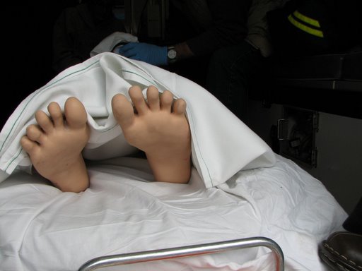 "Richard's" feet. Image from personal collection.