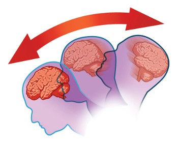 If this brain could speak, it would probably be screaming something like ASFSGHAGDBLASGH right now