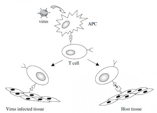 Activation of self-reactive T cells is a critical step in the pathogenesis of autoimmune diseases in RA and lupus