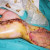 Showing horrendous and life-altering necrosis resulting from Puff Adder bite.  